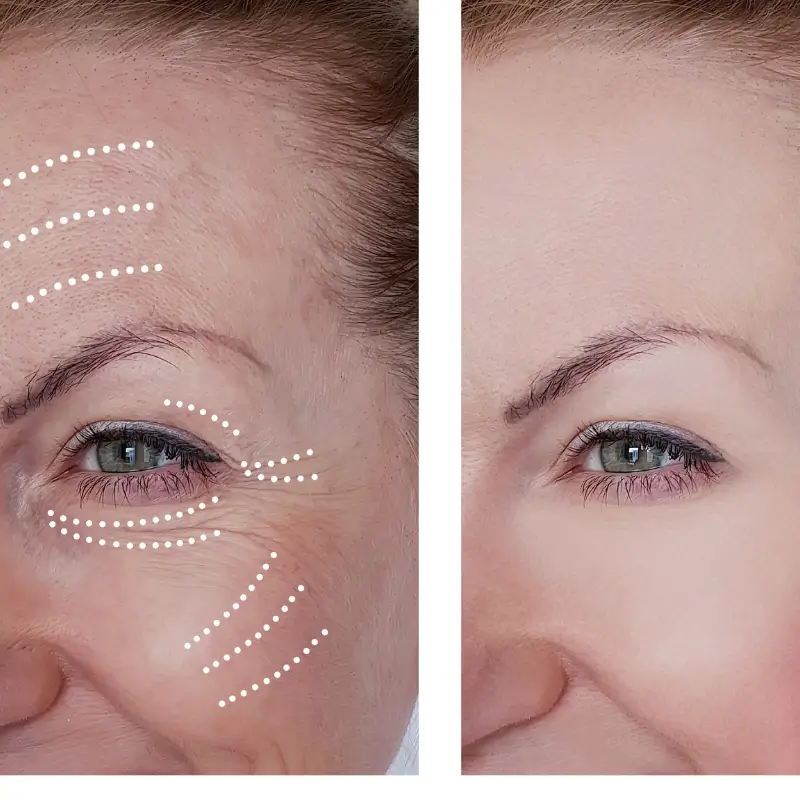 After treatment result