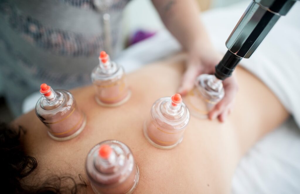 Cupping therapy as part of a regular wellness routine at Pepper Leaf Studio Nenagh